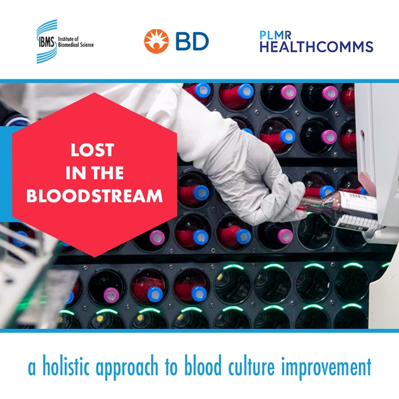 Improving blood culture diagnostics across the NHS