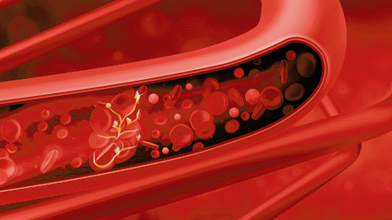 web-p30-32-case-study-red-blood-cells-credit-istock-1227353965-800x500.jpg