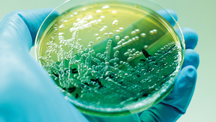 web_p25_IBMS-Research-grants-2022_Sarah-Maddocks_CREDIT_Shutterstock-524153776.jpg