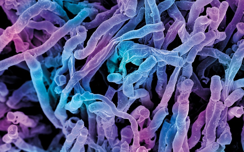 web_p44-45_my-ibms-uk-smis_uk-standards-for-microbiology_actinomyces-viscosus-bacteria_credit_science-photolibrary-f0124030_800x500.jpg