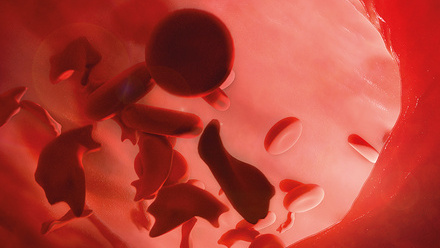 web-p40-42-sickle-cell-sickle-cell-disease-credit-science-photolibrary-c0365318.jpg