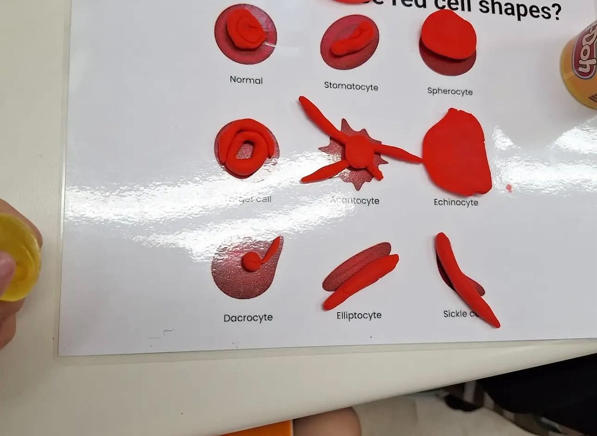 Using Play-Doh to recreate different red blood cell shapes