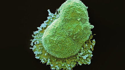 web-p36-38-colorectall-cancer-cell-splibrary-c0481382.jpg