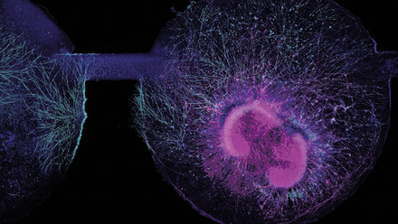 web-p31-organoids-what-is-possible-brain-organoids-light-micrograph-credit-science-photo-library-c0601284.jpg