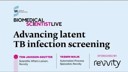 Advancing latent tuberculosis TB infection screening with Tom Jackson-Soutter and Yasmin Malik