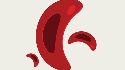 web_p48-51_Feature-Sickle-Cell_CREDIT_iStock-1555377049.jpg