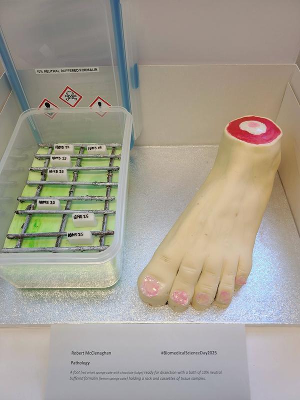 robert-mcclenaghan-nhs-grampain-a-foot-about-to-be-dissected-and-a-bath-of-10-nbf-with-a-rack-and-cassettes-inside-1-1-.jpg