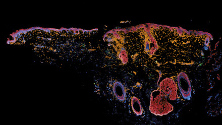 web-p28-31-spatial-transcriptomics-immuno-fluorescence-image-of-a-skin-section-credit-supplied.jpg