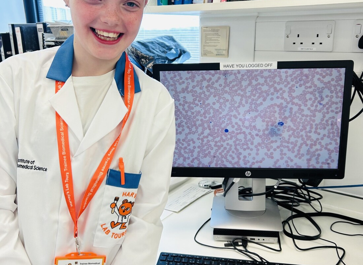 Alice sees her own blood cells on the laboratory screen
