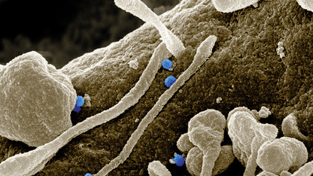 1web-p32-33-crimean-congo-haemorrhagic-fever-cchf-virus-credit-science-photo-library-c0402766.jpg