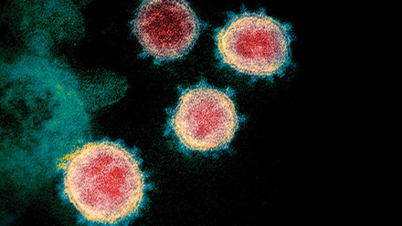 web_p22_Recent-advances-and-updates-in-biomedical-science_Covid-19-Coronavirus-Particles_CREDIT_Science-Photo-Library-C0482773.jpg